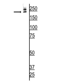 ABCA4 (Rim Protein) Antibody