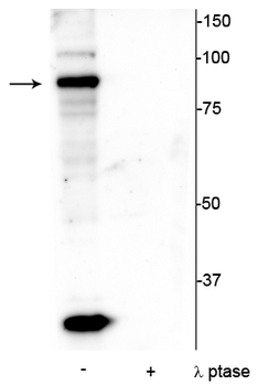 ATRIP (Ser239) Antibody