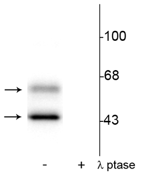 CaM Kinase II (Thr286) Antibody