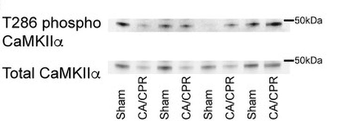CaM Kinase II (Thr286) Antibody