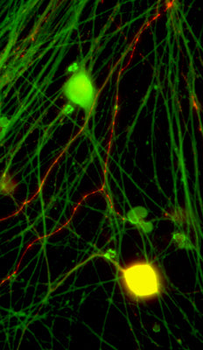 Calcitonin Gene Related Peptide (CGRP) Antibody