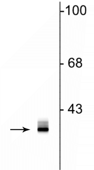 Clavesin Antibody
