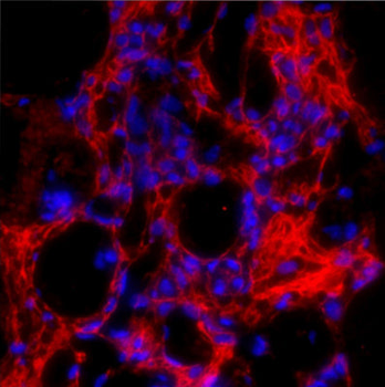 Collagen 1, alpha 1 telopeptide Antibody