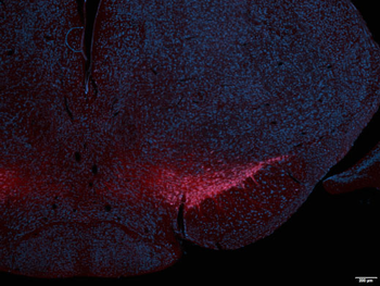 DOPA Decarboxylase Antibody