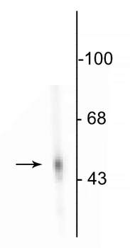 DOPA Decarboxylase Antibody