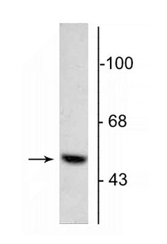 DOPA Decarboxylase Antibody