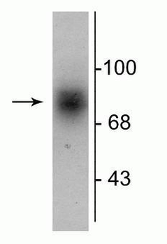 Dopamine Transporter, C-Terminus Antibody