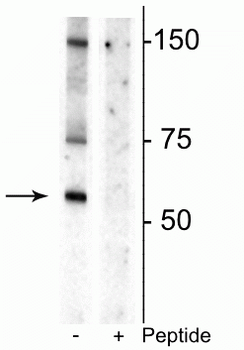 Dopamine Transporter (Thr53) Antibody