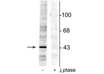EphrinB (Tyr298) Antibody