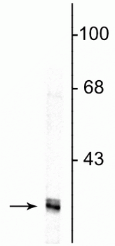 Fibrillarin Antibody