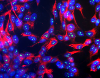Fibrillarin Antibody