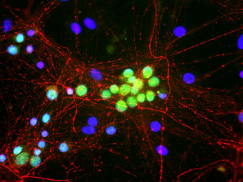 FOX1 Antibody