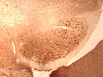 GABAA Receptor α1 Antibody