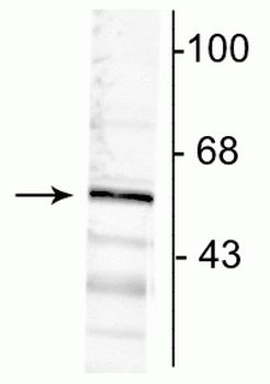 GABAA Receptor α6 Antibody