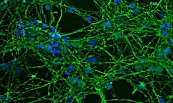 GAP43 Antibody