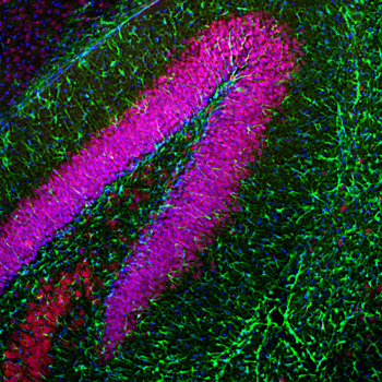 Glial Fibrillary Acidic Protein (GFAP) Antibody