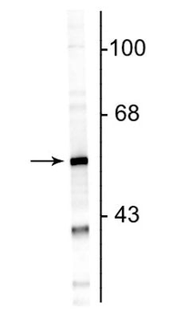 Glial Fibrillary Acidic Protein (GFAP) Antibody