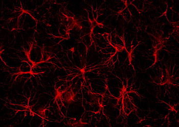 Glial Fibrillary Acidic Protein (GFAP) Antibody