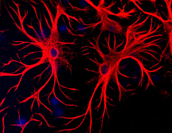 Glial Fibrillary Acidic Protein (GFAP) Antibody