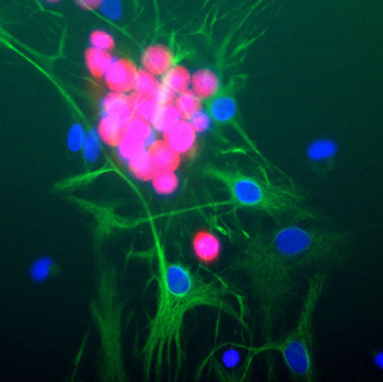 Glial Fibrillary Acidic Protein (GFAP) Antibody