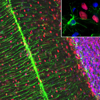 Glial Fibrillary Acidic Protein (GFAP) Antibody