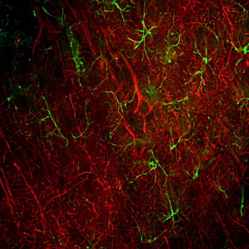 Glial Fibrillary Acidic Protein (GFAP) Antibody