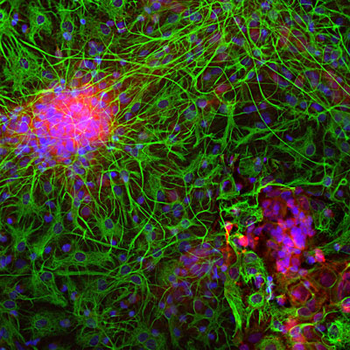 Glial Fibrillary Acidic Protein (GFAP) Antibody