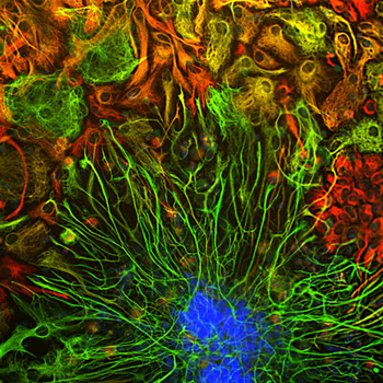 Glial Fibrillary Acidic Protein (GFAP) Antibody