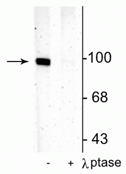 GluR1-Subunit (Ser831) Antibody