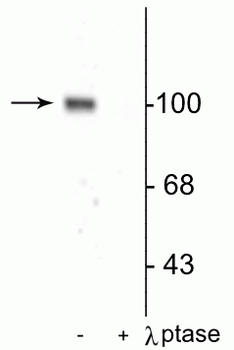 GluR1-Subunit (Ser845) Antibody