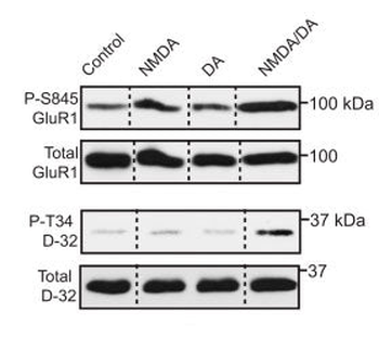 GluR1-Subunit (Ser845) Antibody