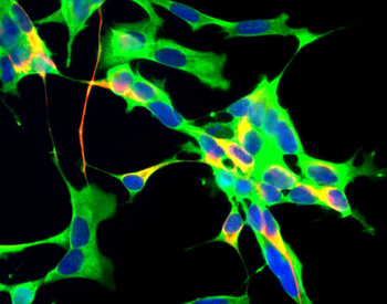 Glyceraldehyde 3-Phosphate Dehydrogenase Antibody