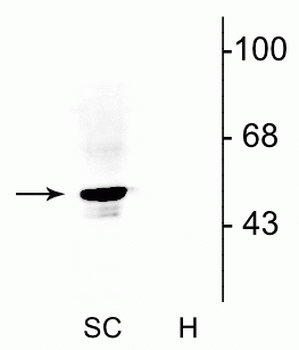 Glycine Receptor Antibody