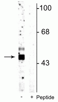 Glycogen synthase kinase 3 B (GSK3B) (Ser9) Antibody