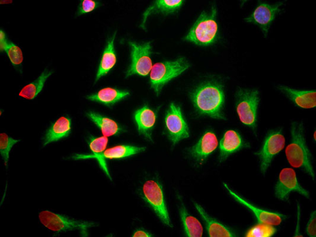 Lamin A/C Antibody