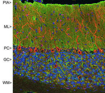 Microtubule Associated Protein 2 (MAP2) Antibody
