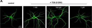 Microtubule Associated Protein 2 (MAP2) Antibody