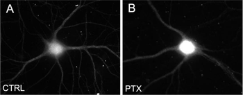 Microtubule Associated Protein 2 (MAP2) Antibody