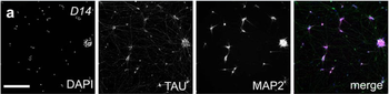 Microtubule Associated Protein 2 (MAP2) Antibody