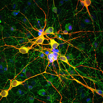 Microtubule Associated Protein 2 (MAP2) Antibody