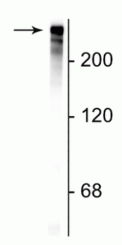 Microtubule Associated Protein 2 (MAP2) Antibody