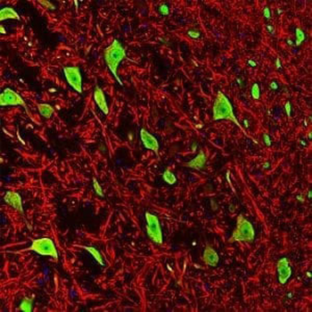 Microtubule Associated Protein 2 (MAP2) Antibody