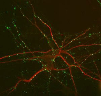 Microtubule Associated Protein 2 (MAP2) Antibody