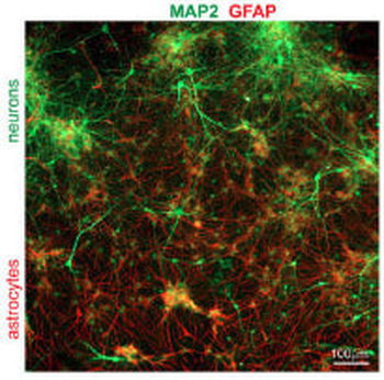 Microtubule Associated Protein 2 (MAP2) Antibody