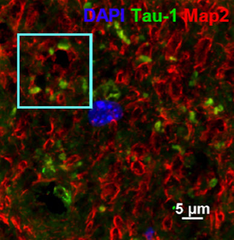 Microtubule Associated Protein 2 (MAP2) Antibody