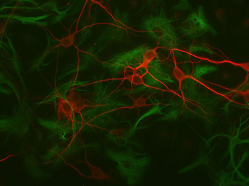 Microtubule Associated Protein 2 (MAP2) Antibody
