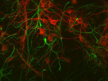 Microtubule Associated Protein 2 (MAP2) Antibody