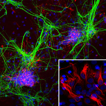 Microtubule Associated Protein 2 (MAP2) Antibody
