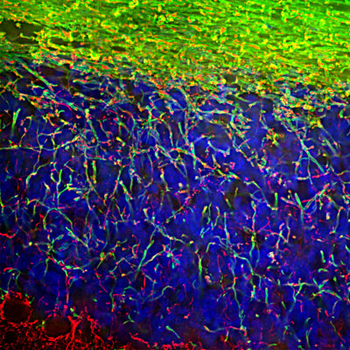 Myelin Basic Protein (MBP) Antibody