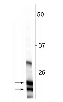 Myelin Basic Protein (MBP) Antibody